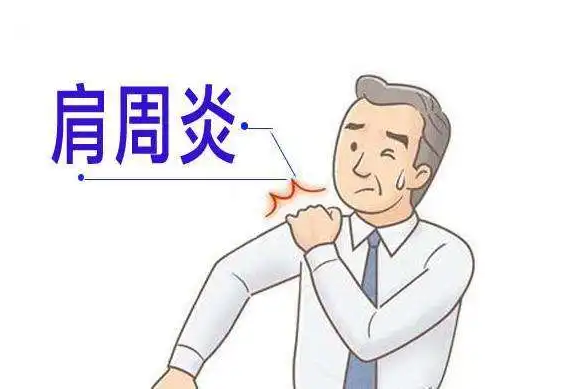 肩关节疼痛？这些康复治疗和技巧帮你轻松搞定！