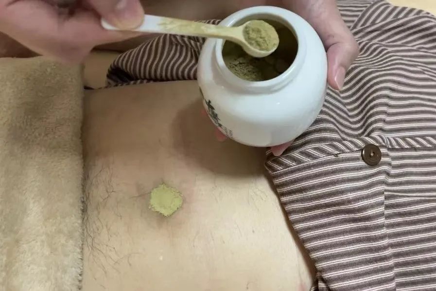 中医外治有讲究，请来一份“面碗脐灸”